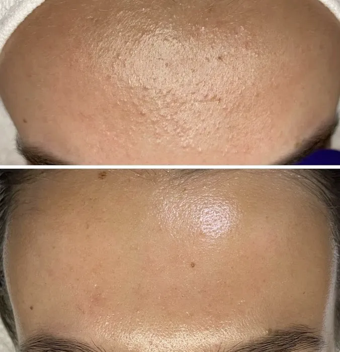 Sun & Moon Skin Picture 4