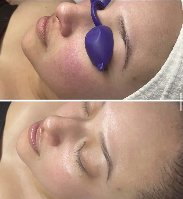 Sun & Moon Skin Picture 2