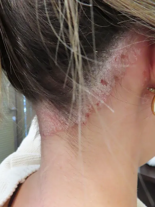 Array Skin Therapy Picture 9