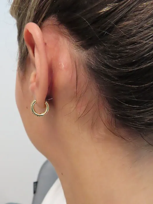 Array Skin Therapy Picture 3