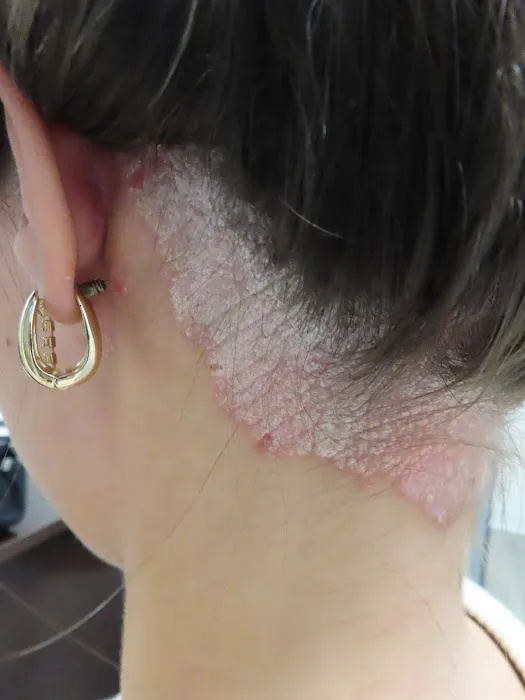 Array Skin Therapy Picture 4