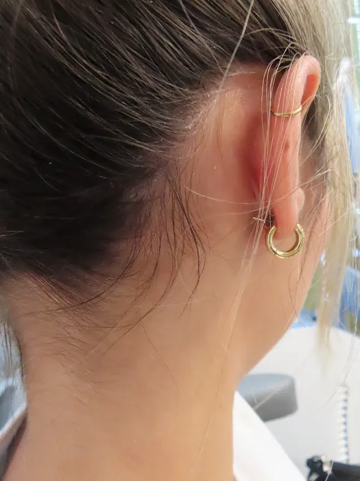 Array Skin Therapy Picture 5