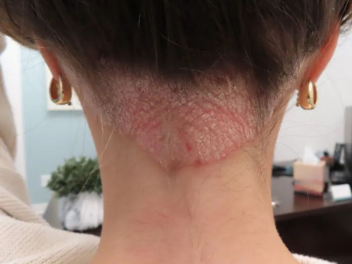 Array Skin Therapy Picture 1