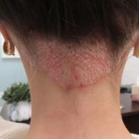 Array Skin Therapy ico