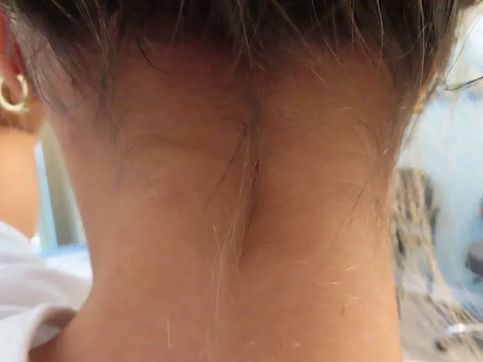 Array Skin Therapy Picture 2