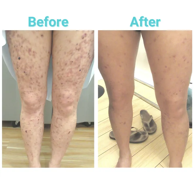 Array Skin Therapy Picture 10