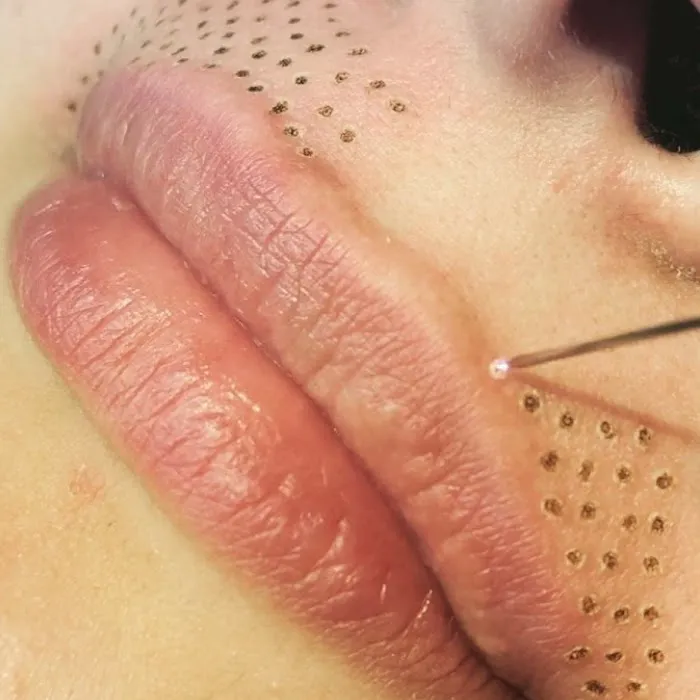 Pleasantly Plasma Picture 5