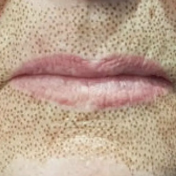 Pleasantly Plasma Picture 4