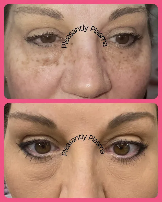 Pleasantly Plasma Picture 3