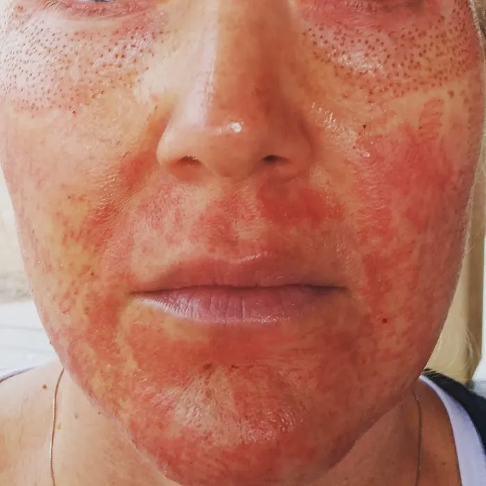 Pleasantly Plasma Picture 8