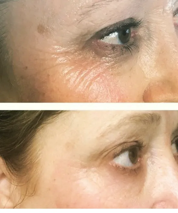 Pleasantly Plasma Picture 7