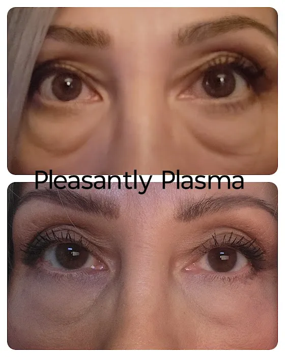 Pleasantly Plasma Picture 10