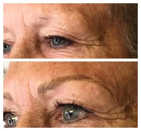 TLC Aesthetics Picture 2