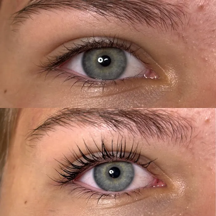 Infinity Skin Vibes Picture 9