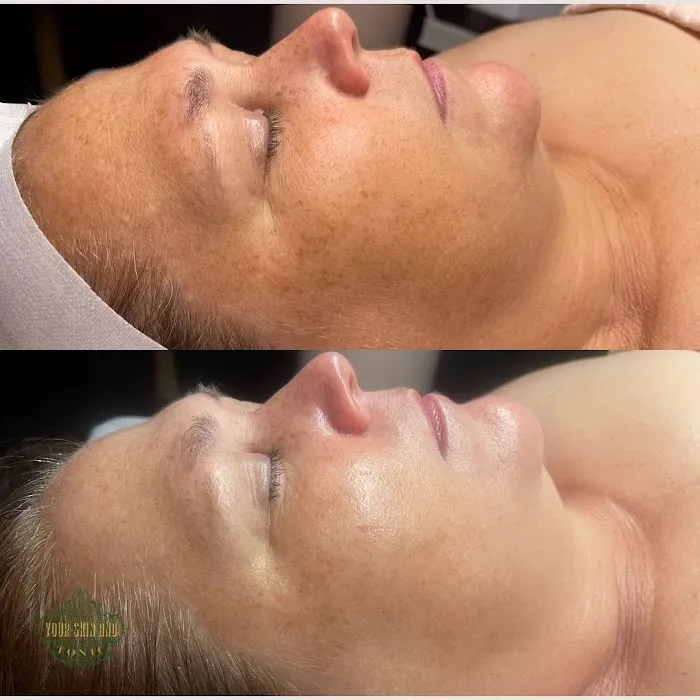 Your Skin and Tonic LLC Picture 6