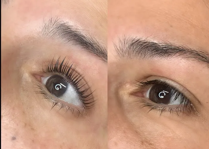 Studio 22 Aesthetics Picture 4