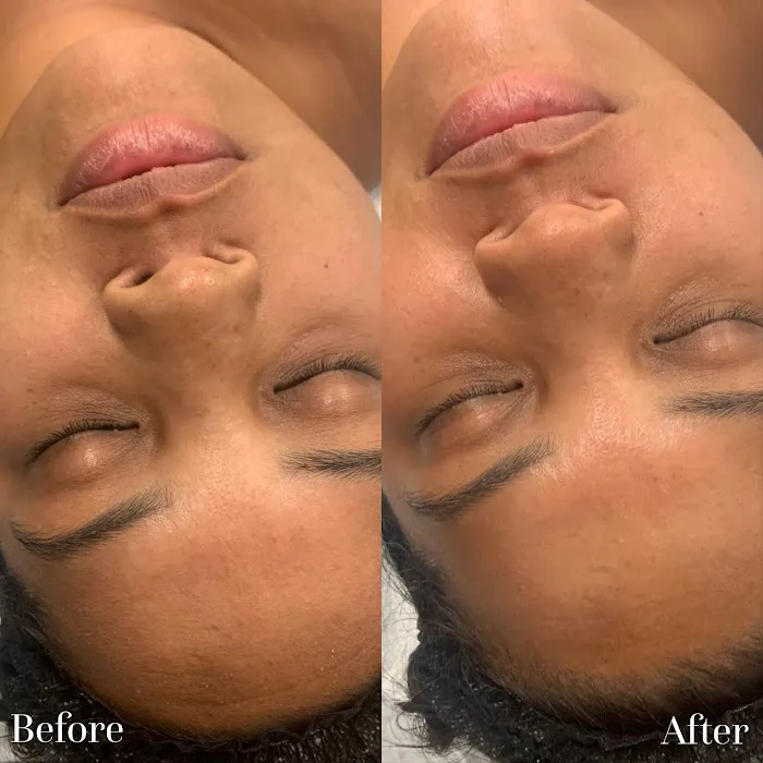 Pōlani Esthetics Picture 2