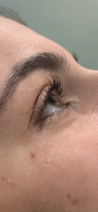 Pōlani Esthetics Picture 3