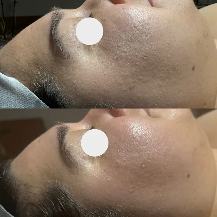 Pōlani Esthetics Picture 5