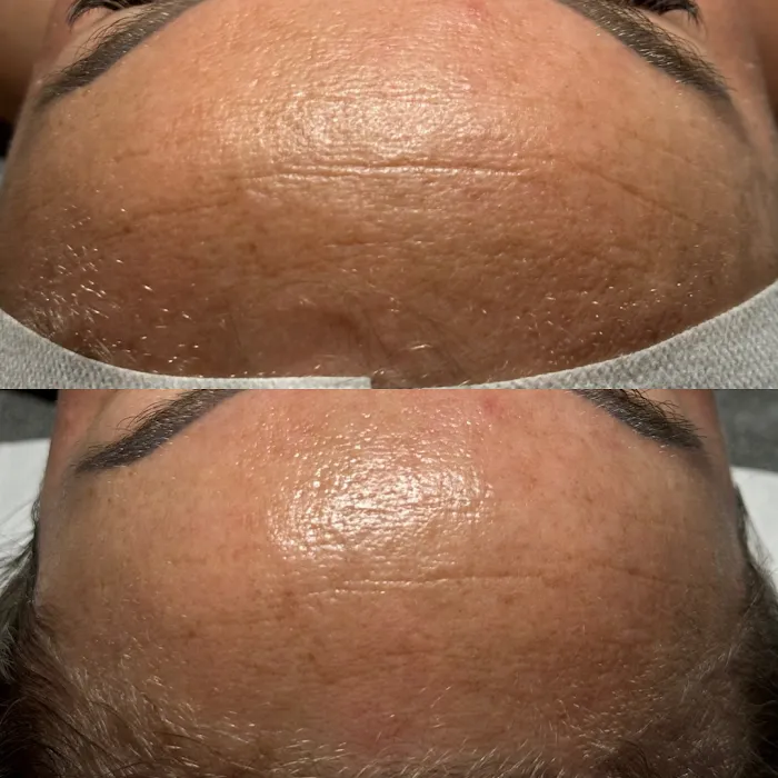 Pōlani Esthetics Picture 7