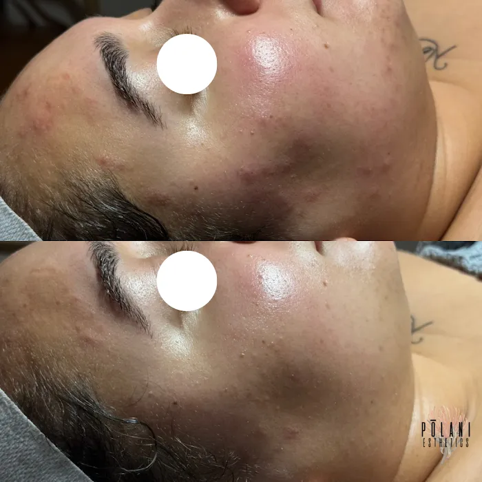 Pōlani Esthetics Picture 8