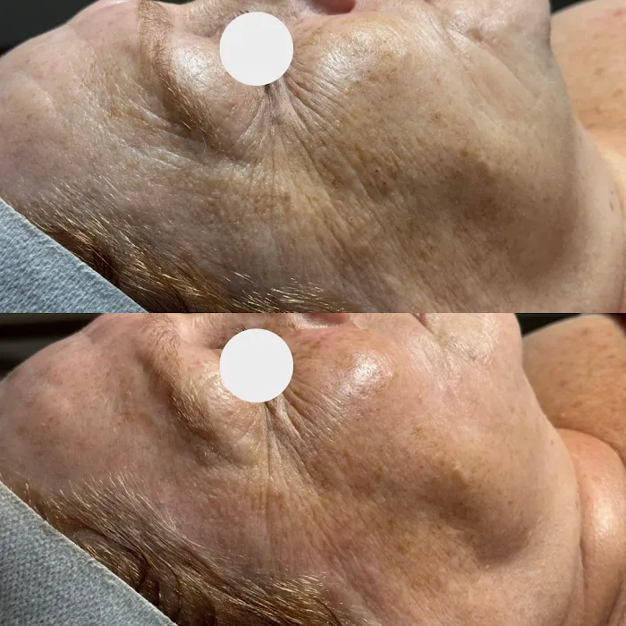 Pōlani Esthetics Picture 6