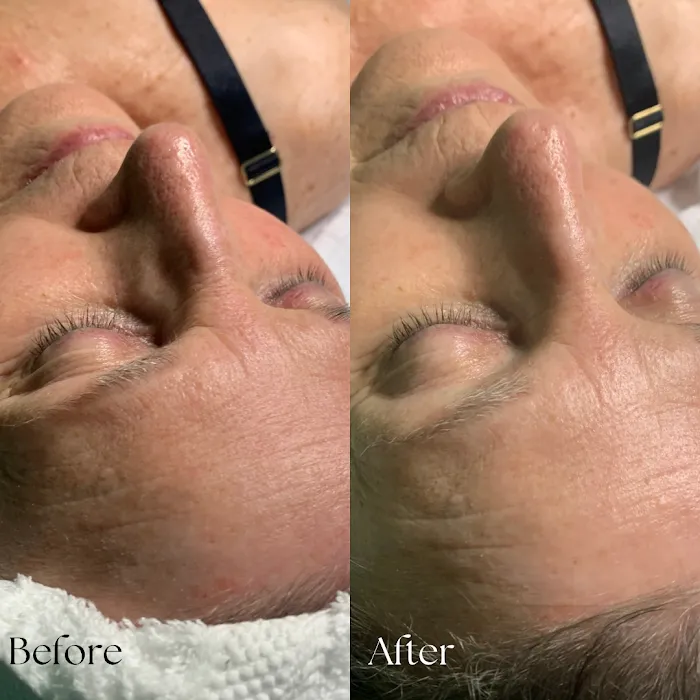 Pōlani Esthetics Picture 9