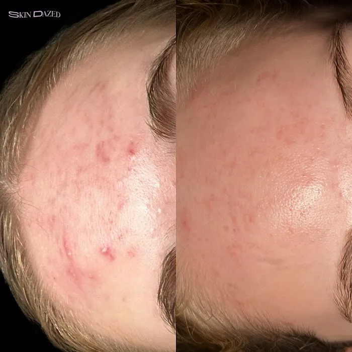 Skin Dazed Aesthetics Picture 5