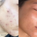 Skin Dazed Aesthetics