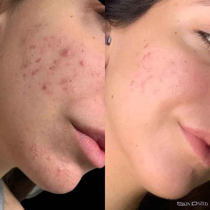 Skin Dazed Aesthetics Picture 2