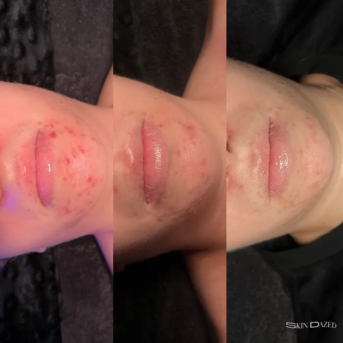 Skin Dazed Aesthetics Picture 4