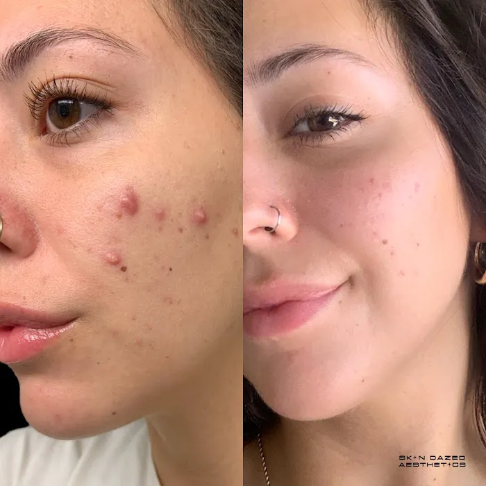 Skin Dazed Aesthetics Picture 3