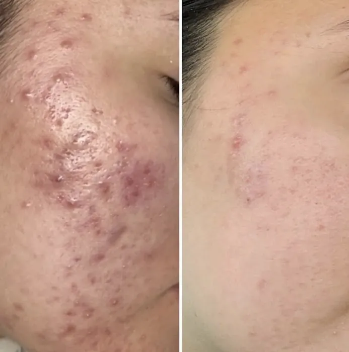 SKINFIT BY SIERRA, LLC Picture 1