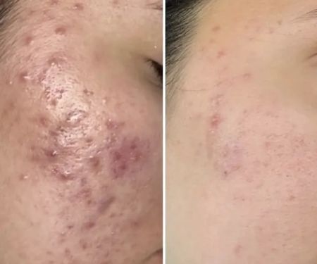 SKINFIT BY SIERRA, LLC