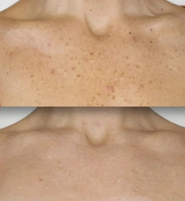 SKINFIT BY SIERRA, LLC Picture 2