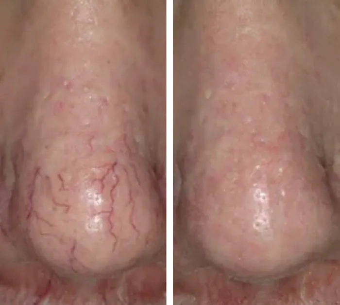 SKINFIT BY SIERRA, LLC Picture 3