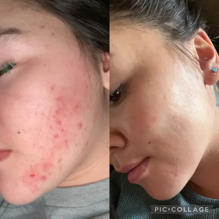 Skin By Mell Picture 1