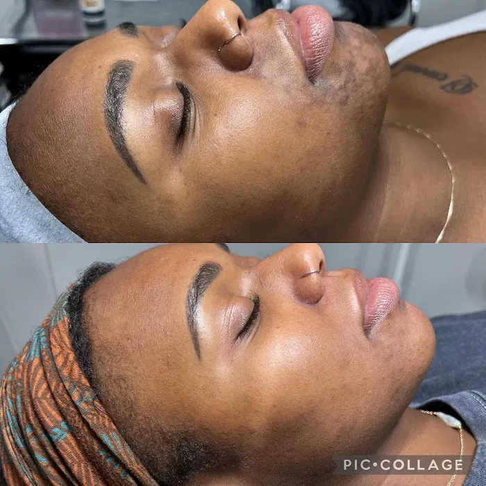 Skin By Mell Picture 6