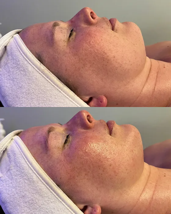 Hello Glow Aesthetics Picture 4