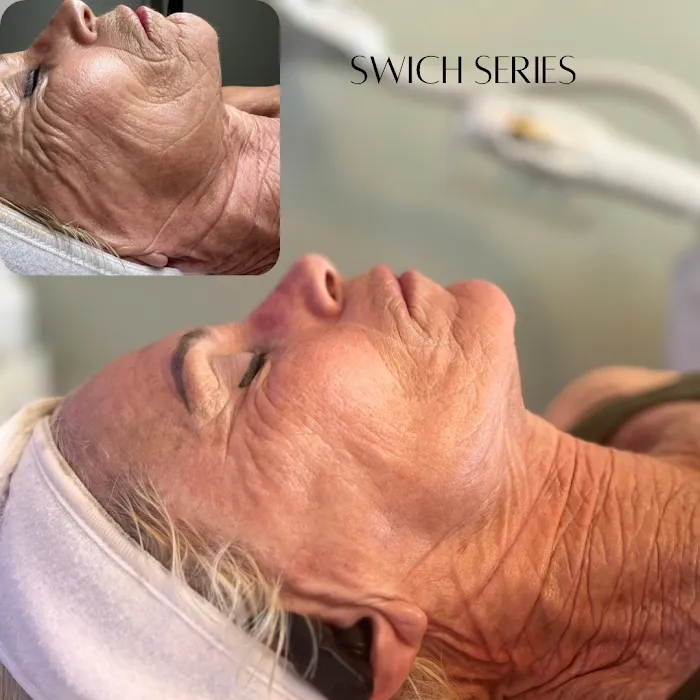 Hello Glow Aesthetics Picture 5