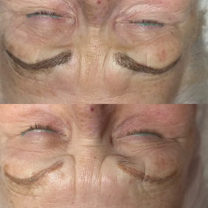 Pure Clinical Skin Picture 1