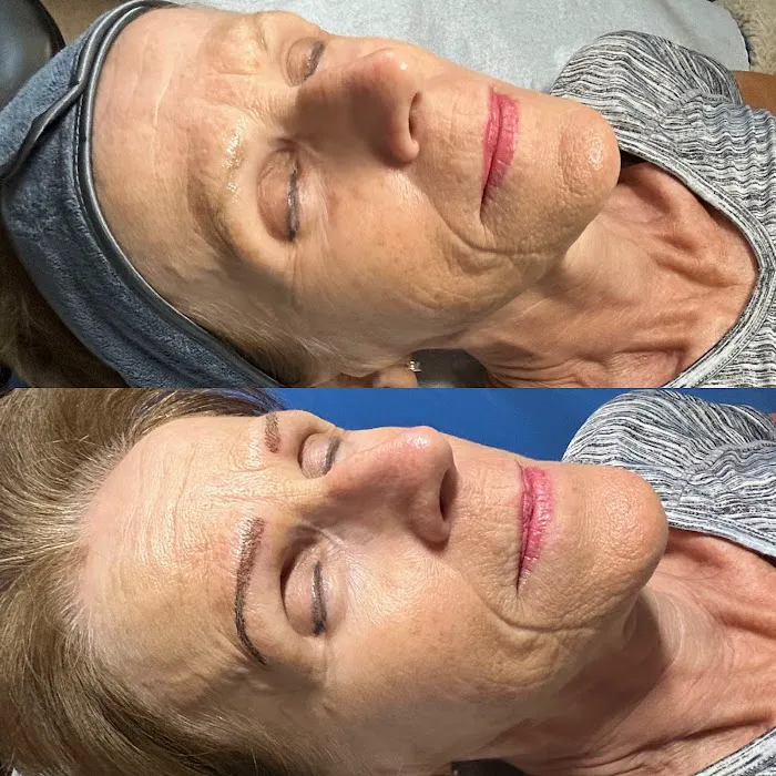 Pure Clinical Skin Picture 3