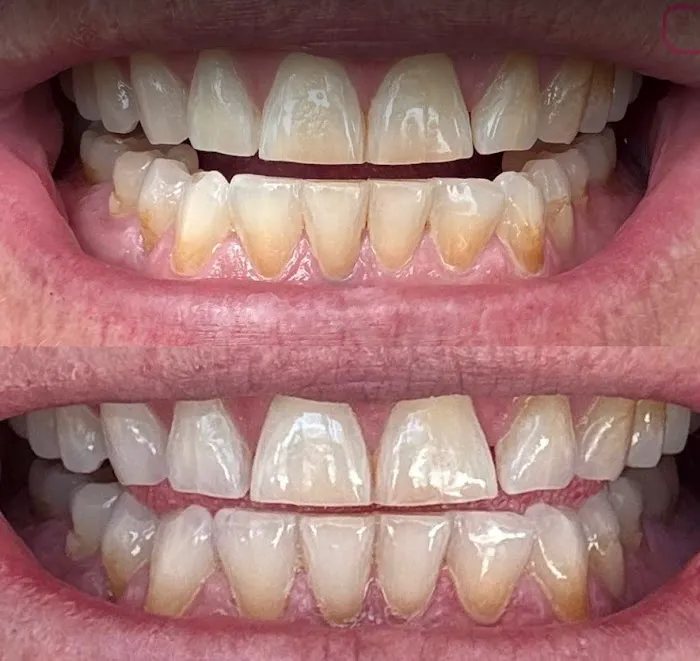 Pure Clinical Skin Picture 4