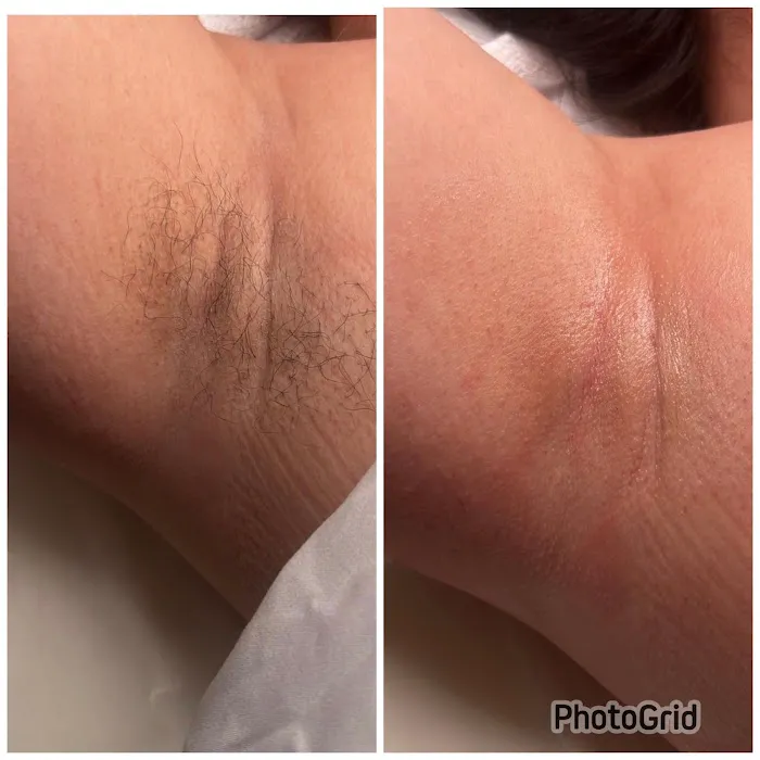 Radiant Beauty Aesthetics Picture 5