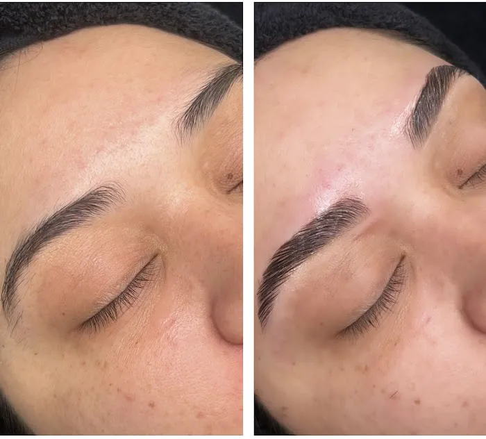 Radiant Beauty Aesthetics Picture 8