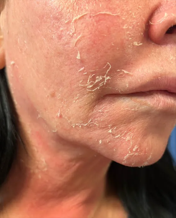 Me by Michelle Picture 10