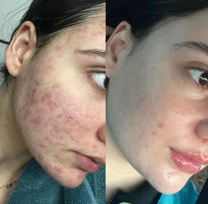 The skin snob Picture 8