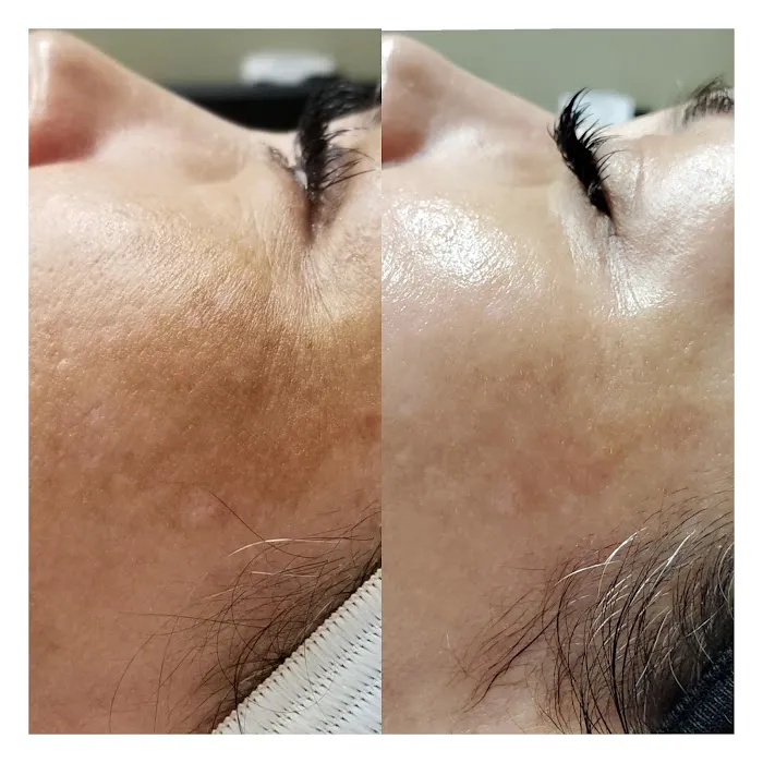 Bella Angelic SkinCare Picture 6