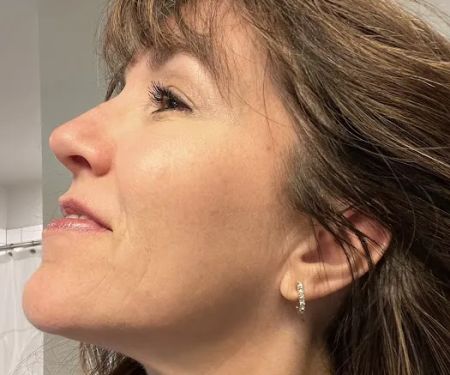 Scottsdale Skin Institute