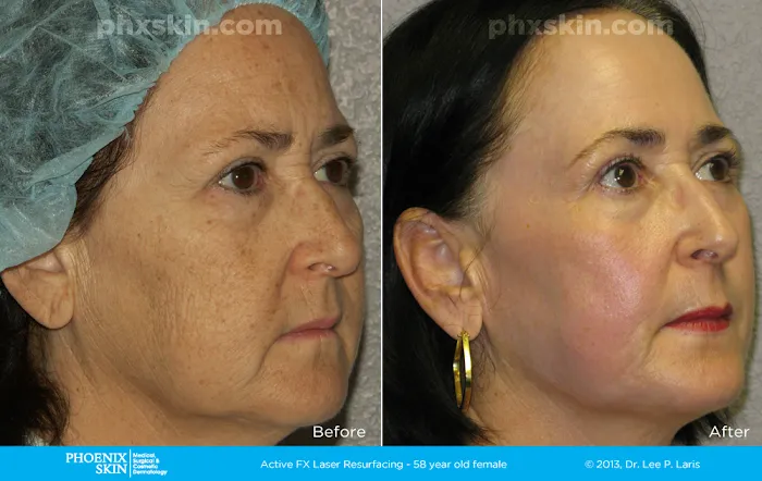 Phoenix Skin Medical Surgical Group Picture 7